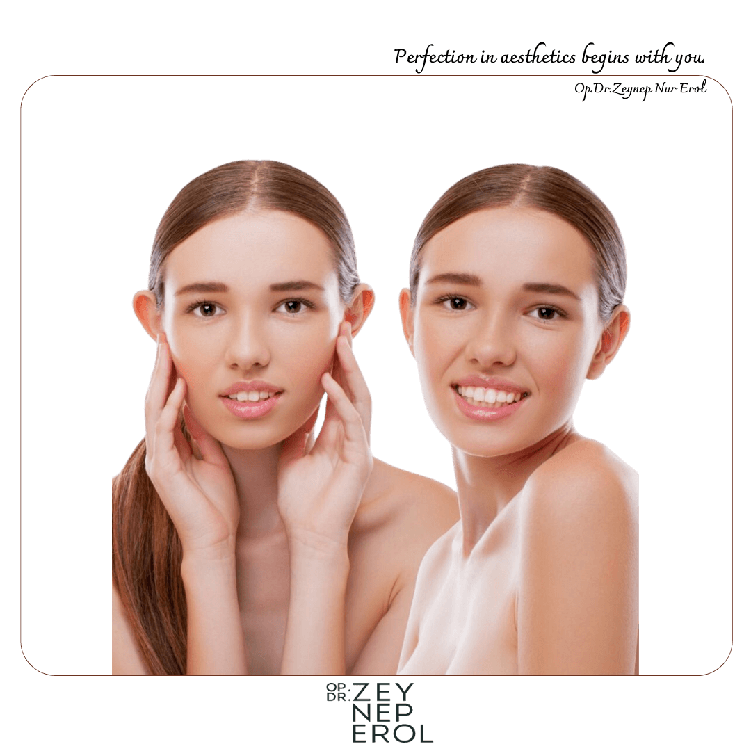 Kepçe Kulak Estetiği